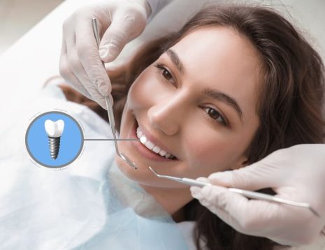 Why Dental Implants Are Considered the Gold Standard for Tooth Replacement