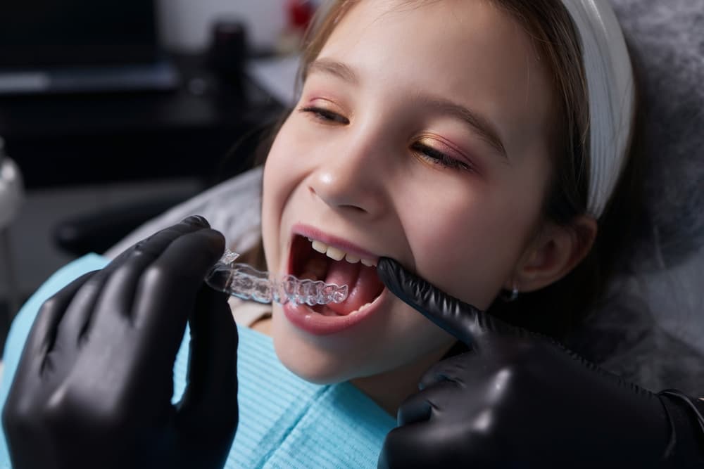 Invisalign at Orchard Dental